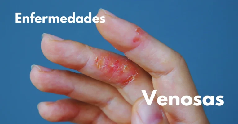 Enfermedades venosas